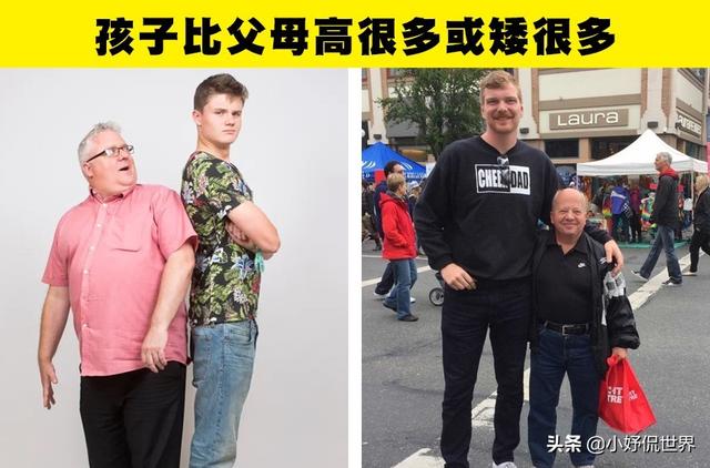 导致孩子出生后拥有与父母惊人差异的5种情况和科学解释