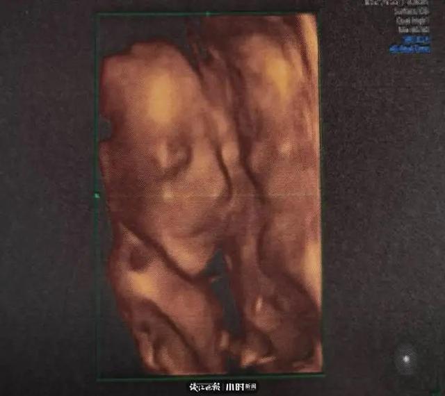 妊娠油可以当作身体乳用吗