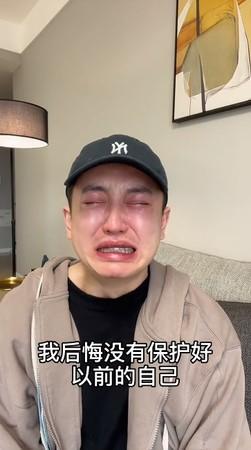 知名網紅金大威因整形失敗變成醜八怪 老歲痛哭 我好後悔 Kks資訊網