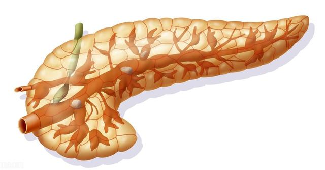 饭后总觉得不舒服？身体出现3个症状，可能是胰腺在向你“求救”