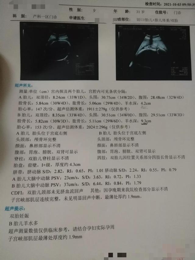 孕31+4双胎羊水差异太大怎么办