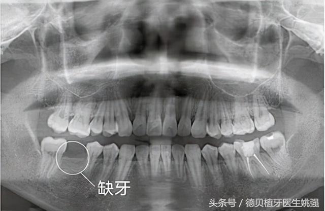 口腔卫生意识淡薄的中国人 和远远不够的口腔医疗资源 今日热点