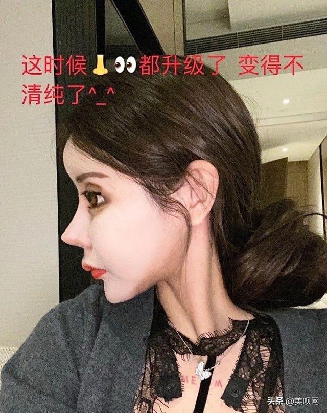 小娜娜整容图片