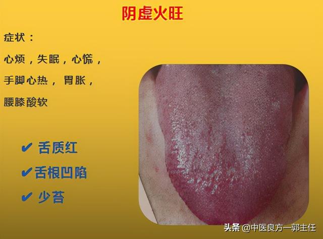 12种“热”藏于体内，反应的舌象、症状各不相同，自查便知