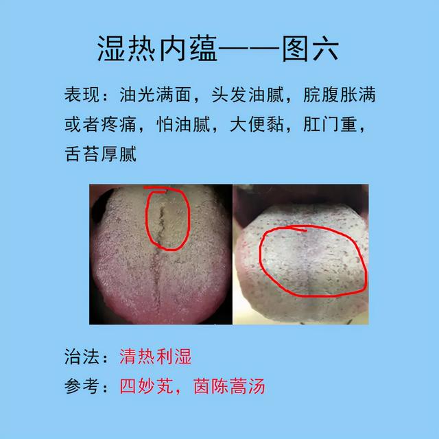 脾胃常见的10种舌象，以及临床表现，后面带解决方法