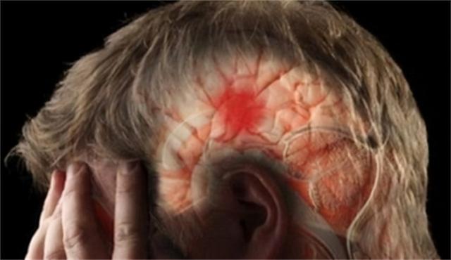 可能会增加患阿尔茨海默病风险的人格特征有哪些？该如何预防？