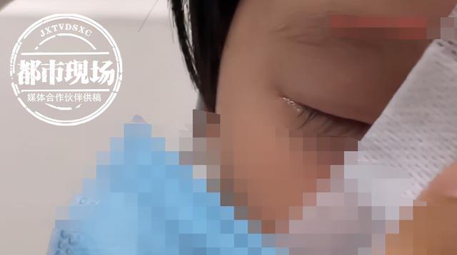 想想都疼！3岁女童不慎摔倒，筷子戳进鼻子断成两截