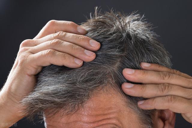 须发早白的天然乌须药