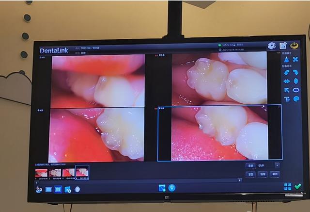 牙医：别给孩子买这种牙膏，刷不干净还浪费钱，选牙膏注意这3点