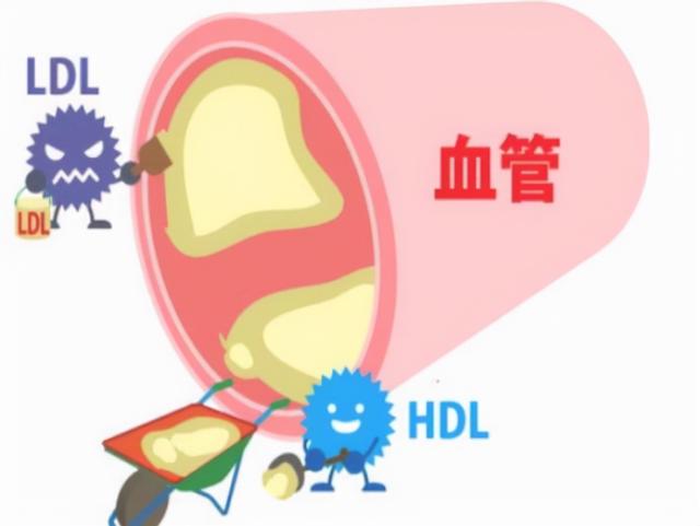 冠状动脉狭窄50%，不放支架怎样治？这里为您答疑解惑