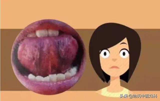 血虚、血瘀、血热、血寒，你是哪一种？中医教你如何调理？