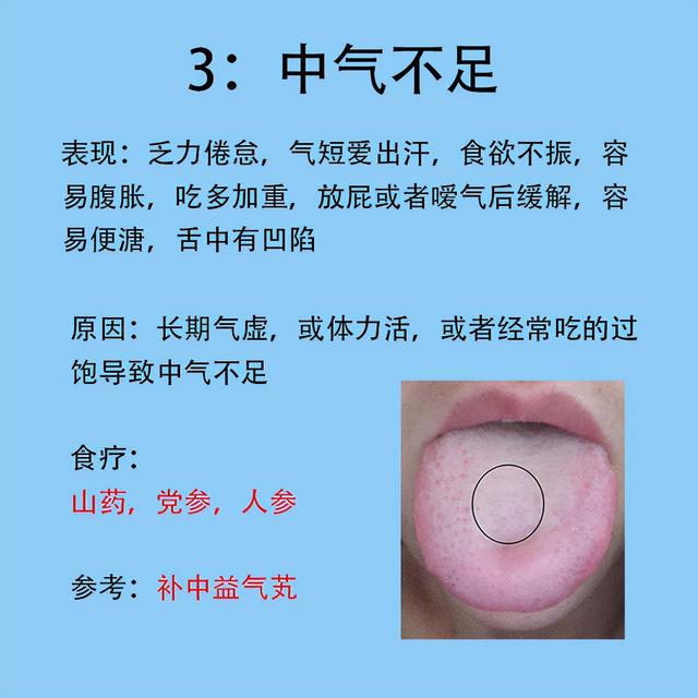 女人常见6种症状，以及对应舌象和解决的方法分享