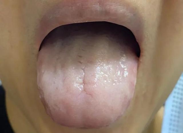 世界厕所日：关于便秘，有用的知识又增加了