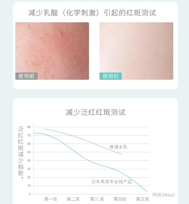 毛周角化病洗面奶
