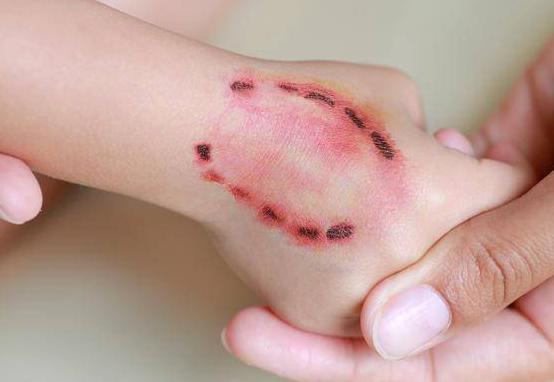 狗狗老是抱着主人的腿咬(狗狗走路总咬主人的腿)-艾拉养犬