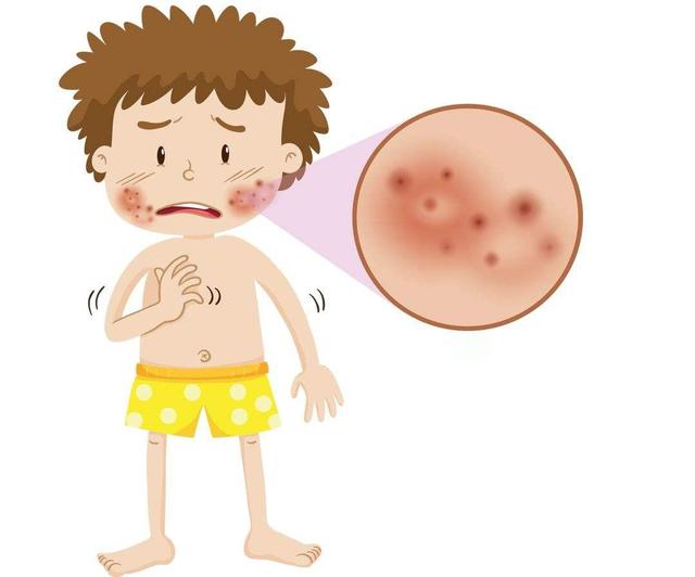 宝宝又出现“湿疹”，这“3大禁忌，9个注意”宝妈一定要知道！