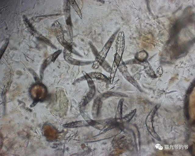 外阴表皮角化不全什么意思