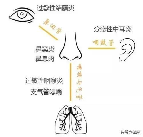 季节感受器——过敏性鼻炎，强冷空气来之前的自我调治与护理