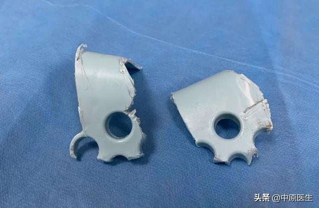 小孩子将手指头伸进凳子洞被卡到肿胀发紫，专家：警惕这些地方