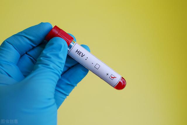 核苷类药物影响怀孕吗？多久可以停药？医生指出6个对策