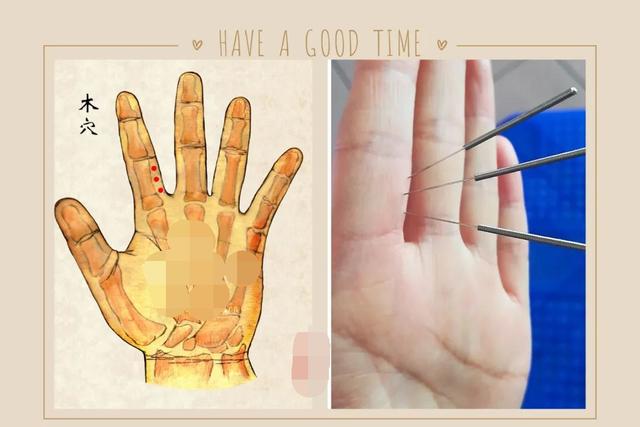 中医针灸感冒、上呼吸道感染疾病处方2