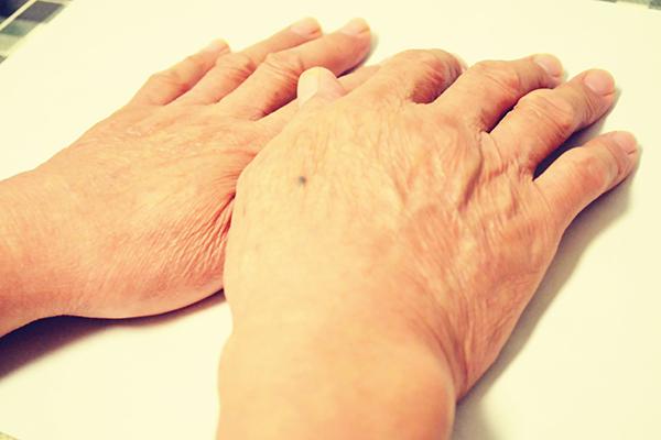 40多岁的女性，头顶多白发，说明老了？白发能不能转黑？听医生说