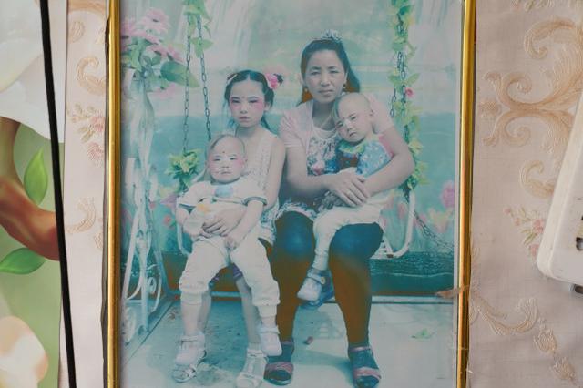 女子意外怀孕后不顾反对生下双胞胎，医生看后断言：活不过18岁