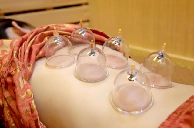 拔火罐时，后背吸出来的瘀血，真的是毒素吗？医生告诉你实话