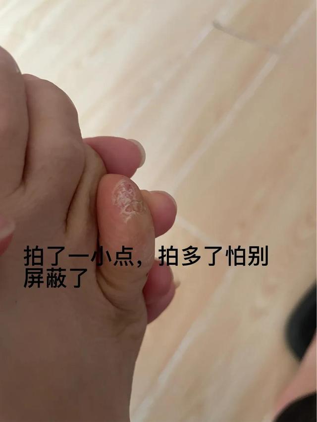 你落下什么严重的月子病吗？我牙齿一碰就出血，手腕疼的跪地上哭