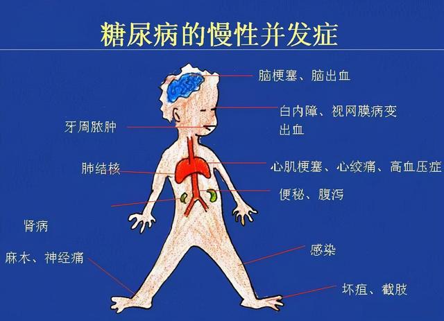 糖尿病为什么越治越严重？答案在这里