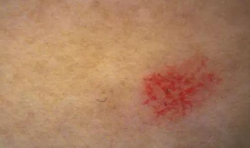 身体乳二氧化钛