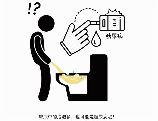 出现泡沫尿就是肾出问题了？未必，还有这几个因素，需要了解