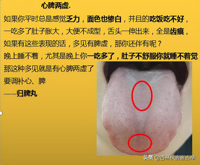治疗失眠的中成药大总结，失眠、多梦、入睡困难再也不怕用错药