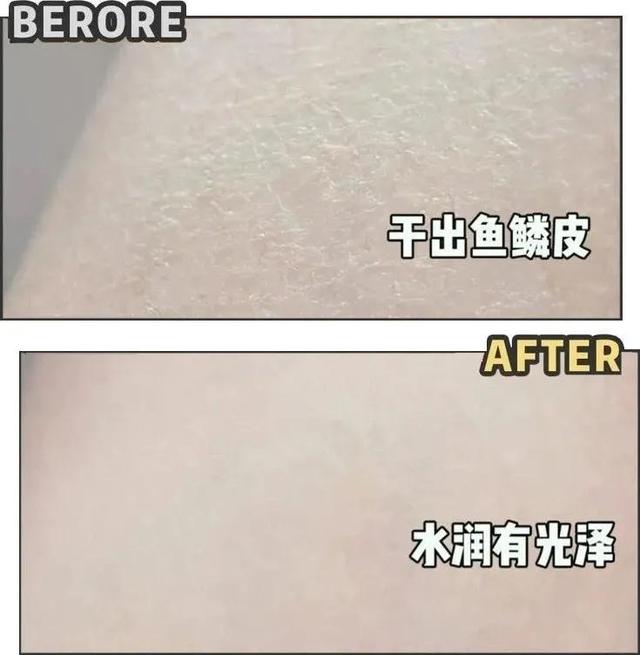 一年四季都需要涂身体乳嘛