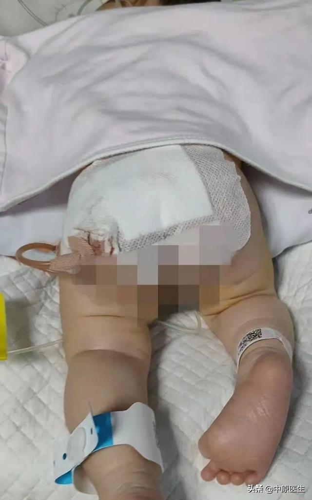 怀孕时查出胎儿患了肿瘤，妈妈还是决定把他生下，出生三天做手术