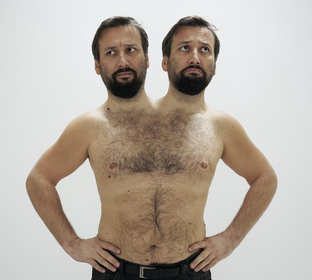 两个大脑指挥一个身躯，真的能保证不吵架吗？连体婴生活大揭秘