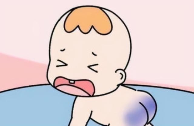 新生儿屁股的“淤青”是怎么弄的？不是投胎时被踢，或与亲人有关