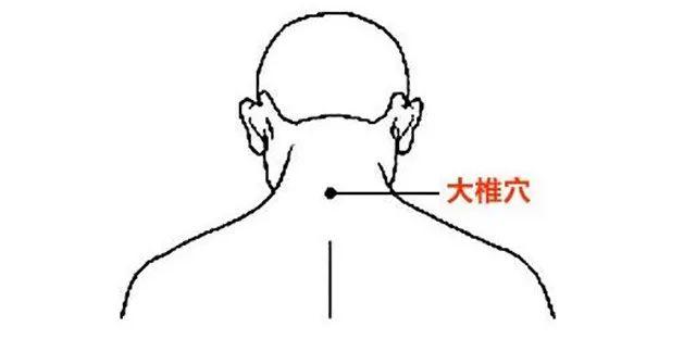 横纹是脑梗纹、竖纹是脑出血纹、凸起是炸药包，一定要及时疏通