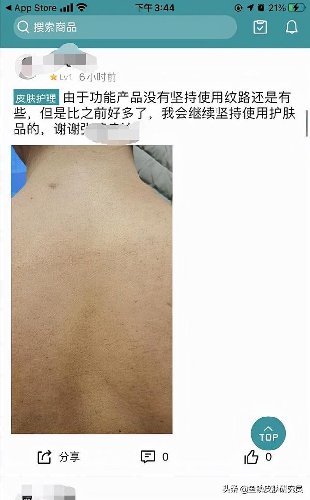 鱼鳞病有人治好的吗