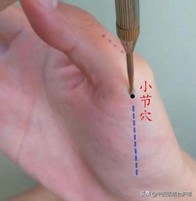 「中医养生」万能的小节穴
