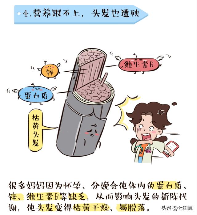 产后掉发严重怎么办？教你5个小妙招