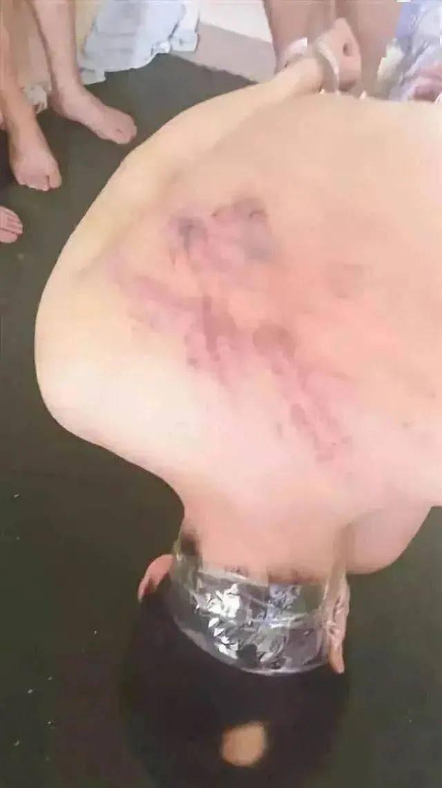 男子为挣大钱，被骗缅北后遭受非人待遇，跳楼逃生被抓后险遭活埋