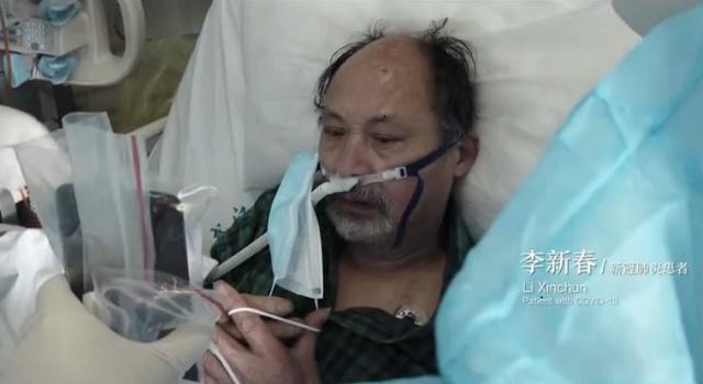 首批新冠幸存者：含泪捐献父亲遗体，20天抢救瘦了40斤