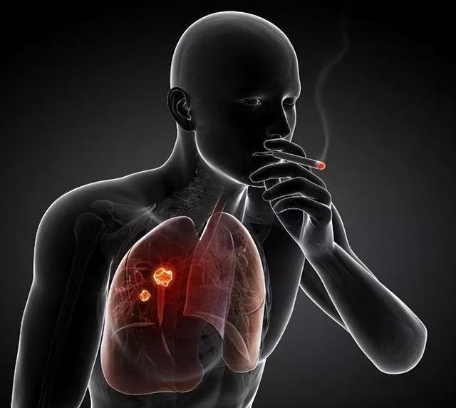 吸烟的人，早上起床后若没有这3种“不适”，说明你的肺还算干净