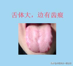临床常见的9种舌象，对照自测