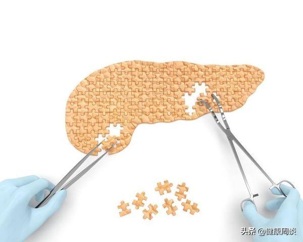 得了胰腺癌，能活多久？医生：注意4个细节，胰腺会好受点