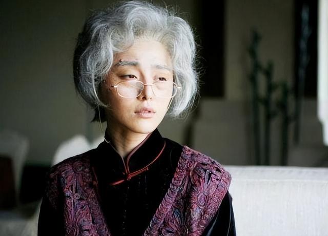 白发长在哪，暗示病从哪出？长在两鬓、前额、后脑勺分别说明什么