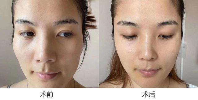 女人40岁怎样抗衰老