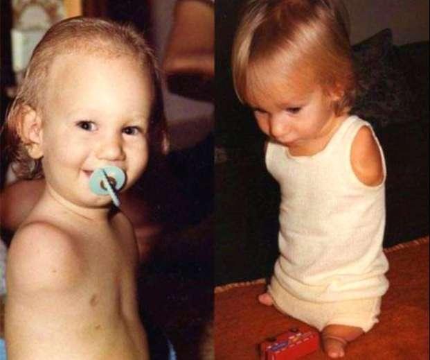 生来无四肢，母亲四个月不敢抱，40年后小男孩活成了什么样