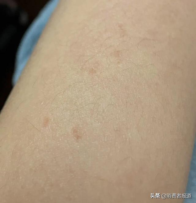 身体乳发酸